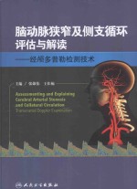 脑动脉狭窄及侧支循环评估与解读 经颅多普勒检测技术