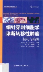 细针穿刺细胞学诊断转移性肿瘤 技巧与陷阱