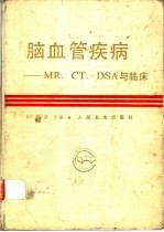 脑血管疾病 MR、CT、DSA与临床