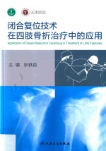 闭合复位技术在四肢骨折治疗中的应用