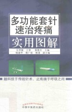 多功能套针速治疼痛实用图解