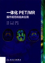 一体化PET/MR操作规范和临床应用