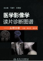 医学影像学读片诊断图谱  头颈分册