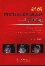 新编图文超声诊断测试题 1700题