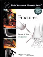 FRACTURES THIRD EDITION