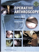 OPERATIVE ARTHROSCOPY FOURTH EDITION