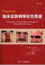 Fitzpatrick临床皮肤病学彩色图谱 第5版