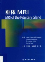 垂体MRI 翻译版