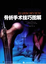 Harborview骨折手术技巧图解