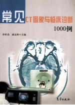 常见CT图像临床诊断1000例