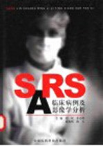 SARS临床病例及影像学分析