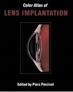 COLOR ALTAS OF LENS IMPLANTATION