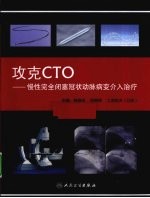 攻克CTO 慢性完全闭塞冠状动脉病变介入治疗