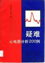 疑难心电图分析200例