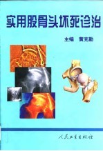 实用股骨头坏死诊治