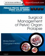 SURGICAL MANAGEMENT OF PELVIC ORGAN PROLAPSE