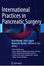 INTERNATIONAL PRACTICES IN PANCREATIC SURGERY