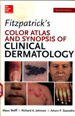 FIZPATRICK'S COLOR ATLAS AND SYNOPSIS OF CLINICAL DERMTOLOGY SEVENTH EDITION