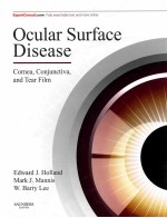 OCULAR SURFACE DISEASE:CORNEA