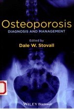 OSTEOPOROSIS DIAGNOSIS AND MANAGEMENT