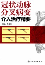 冠状动脉分叉病变介入治疗精要